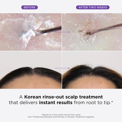 Dr. Groot Miracle in Shower Moisturizing Treatment for Hair Loss, Korean Hair Care Rinse, Rosemary Oil for Smooth, Healthier-Looking Hair in 5 Seconds, Scalp Revitalizing Solution