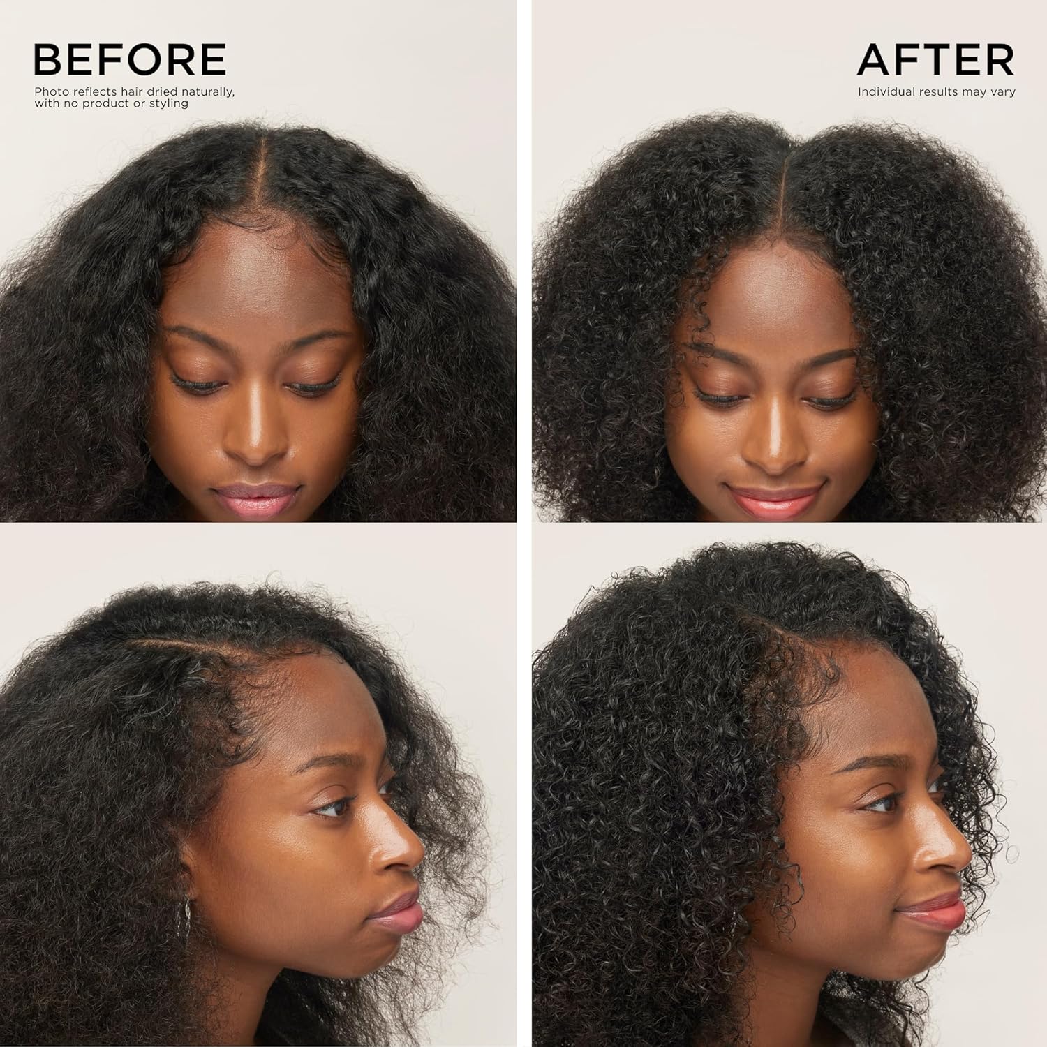 Dr. Groot Award-Winning Hair Thickening Serum for Hair Loss, Korean Hair Care, Scalp Treatment, Clinically Tested, Reduces Oil, Roll On