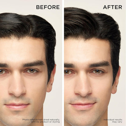 Dr. Groot Thickening Shampoo & Scalp Treatment Set for Hair Loss – Clinical Results with Biotin and Rosemary for Hair Thinning, Shedding, Scalp Repair and Treatment